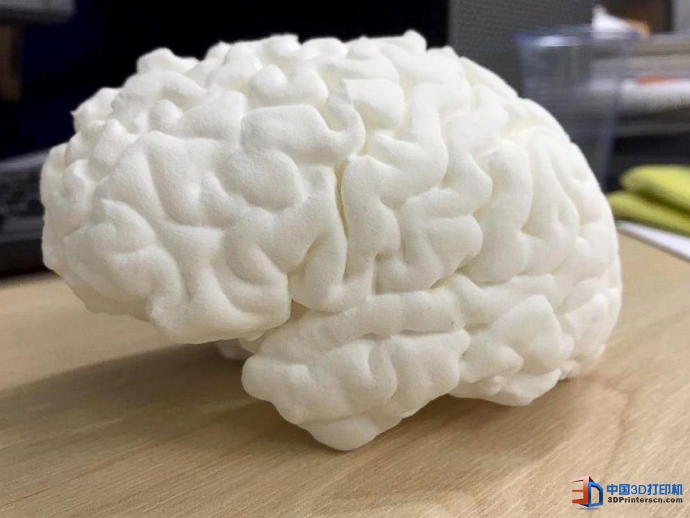 未來醫(yī)療行業(yè) 3D打印技術融入其中的四種方式

3D醫(yī)療行業(yè),3D打印心臟,3D打印大腦,3D打印應用,3D打印領域,3D打印和醫(yī)療的關系,3D打印平臺,3D打印服務,3d打印企業(yè)服務平臺