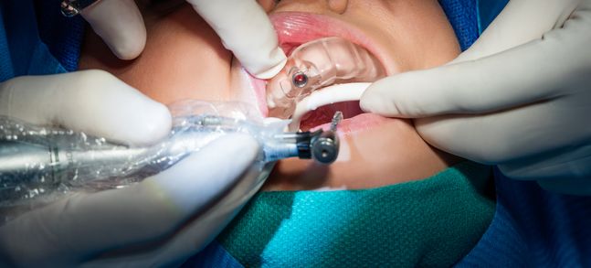 Formlabs創(chuàng)舉 生物相容性3D打印樹脂Dental SG誕生記

3d打印樹脂,3d打印樹脂材料,3d打印材料有哪些,3d打印材料價(jià)格,3d打印耗材,大連3d打印,大連3d打印機(jī),大連3d打印公司