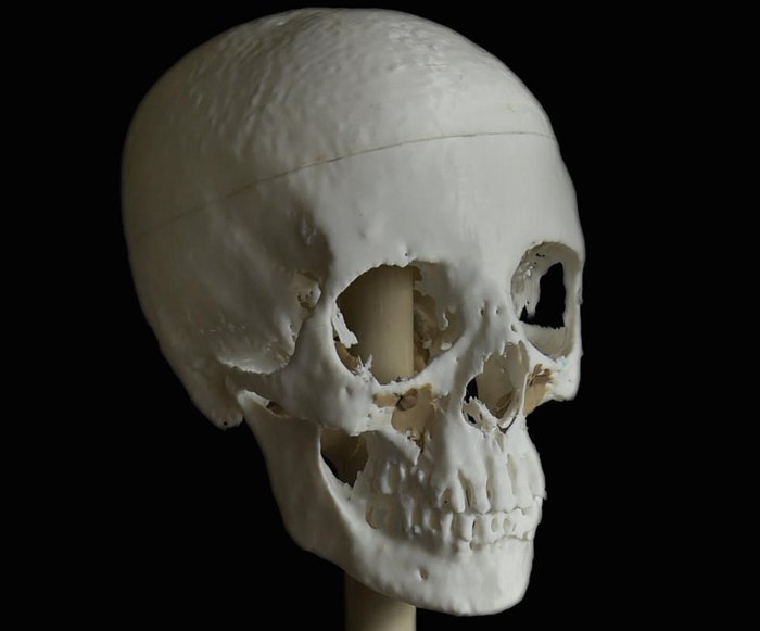 3D打印應用修復典型案例 用3D打印技術修復千年木乃伊面部容顏