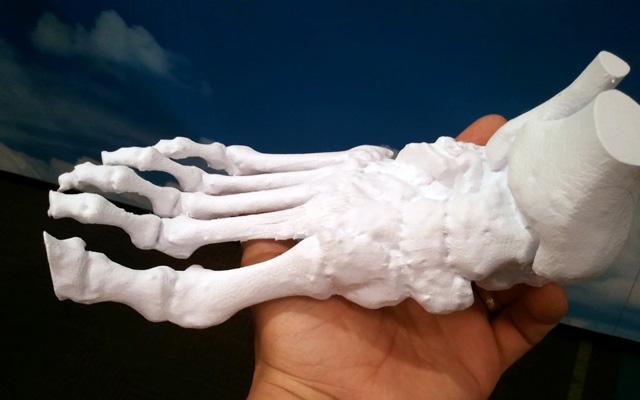 3d打印應用領(lǐng)域之醫(yī)療應用_e鍵打印服務公司